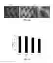 Fig. 04 - Mesenchymal Stem Cell-Hydrogel-Biodegradable or Mesenchymal Stem Cell-Hydrogel-Undegradable Support Composition for Skin Regeneration or Wound Healing