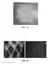 Fig. 05 - Mesenchymal Stem Cell-Hydrogel-Biodegradable or Mesenchymal Stem Cell-Hydrogel-Undegradable Support Composition for Skin Regeneration or Wound Healing