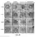Fig. 11 - Mesenchymal Stem Cell-Hydrogel-Biodegradable or Mesenchymal Stem Cell-Hydrogel-Undegradable Support Composition for Skin Regeneration or Wound Healing