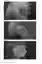 Fig. 05 - Bone graft composition and preparation method thereof