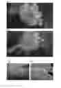 Fig. 06 - Bone graft composition and preparation method thereof