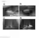 Fig. 10 - Bone graft composition and preparation method thereof