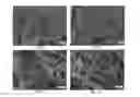 Fig. 02 - Decellularized adipose tissue