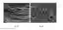 Fig. 03 - Decellularized adipose tissue