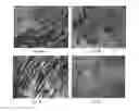 Fig. 05 - Decellularized adipose tissue