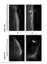 Fig. 03 - Reparative cell isolation and delivery