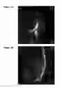 Fig. 04 - Reparative cell isolation and delivery