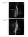 Fig. 06 - Reparative cell isolation and delivery