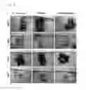 Fig. 08 - HYBRID GEL COMPRISING PARTICULATE DECELLULARIZED TISSUE