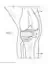 Fig. 04 - Shapeable bone graft substitute and instruments for delivery thereof