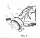 Fig. 02 - Ventricular cuff