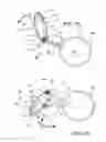 Fig. 08 - Ventricular cuff