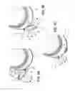 Fig. 12 - Ventricular cuff
