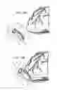Fig. 13 - Ventricular cuff