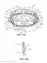 Fig. 16 - Ventricular cuff