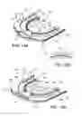 Fig. 17 - Ventricular cuff