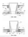 Fig. 32 - Ventricular cuff