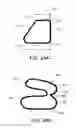 Fig. 33 - Ventricular cuff