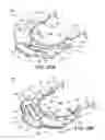 Fig. 35 - Ventricular cuff