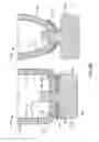 Fig. 48 - Ventricular cuff