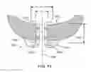 Fig. 54 - Ventricular cuff