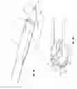 Fig. 04 - Solid-body catheter including lateral distal openings