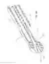 Fig. 31 - Solid-body catheter including lateral distal openings
