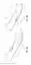 Fig. 38 - Solid-body catheter including lateral distal openings