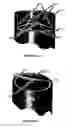 Fig. 05 - Nebulizer device and mask of inhalation solution