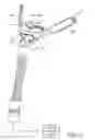 Fig. 02 - Nasal prong and patient interface device including the same