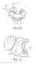 Fig. 11 - Nasal prong and patient interface device including the same