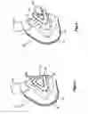 Fig. 07 - Mask