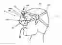 Fig. 01 - Breathing assistance apparatus