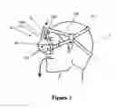 Fig. 03 - Breathing assistance apparatus