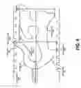 Fig. 05 - ADJUSTING A POSITION OF A HEATING WIRE WITHIN A BREATHING CIRCUIT