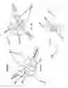 Fig. 10 - Apparatus, systems, and methods for treating obstructive sleep apnea