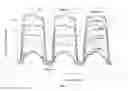 Fig. 11 - Apparatus, systems, and methods for treating obstructive sleep apnea