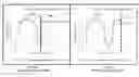 Fig. 15 - Apparatus, systems, and methods for treating obstructive sleep apnea
