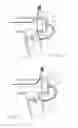 Fig. 18 - Respiratory valve apparatus