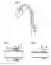 Fig. 02 - Catheter device having a catheter and an actuation device