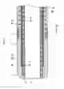 Fig. 04 - Catheter, catheter manipulation part, and catheter manufacturing method