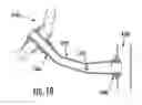 Fig. 07 - VASCULAR CONDUIT DEVICE AND SYSTEM FOR IMPLANTING