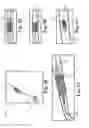 Fig. 18 - Devices and Systems for Access and Navigation of Cerebrospinal Fluid Space
