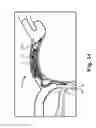 Fig. 20 - Devices and Systems for Access and Navigation of Cerebrospinal Fluid Space