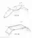 Fig. 02 - Partial Circumferential Stent With Non-Radial Apposition