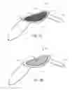 Fig. 07 - Partial Circumferential Stent With Non-Radial Apposition