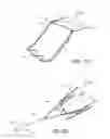 Fig. 09 - Partial Circumferential Stent With Non-Radial Apposition