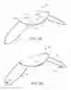 Fig. 04 - Partial Circumferential Stent With Non-Radial Apposition