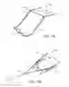 Fig. 09 - Partial Circumferential Stent With Non-Radial Apposition