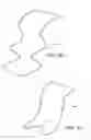 Fig. 11 - Partial Circumferential Stent With Non-Radial Apposition